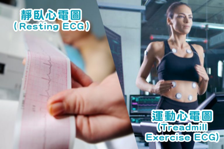 靜臥心電圖 vs 運動心電圖