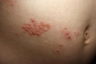 拆解10大常見「生蛇」疑問