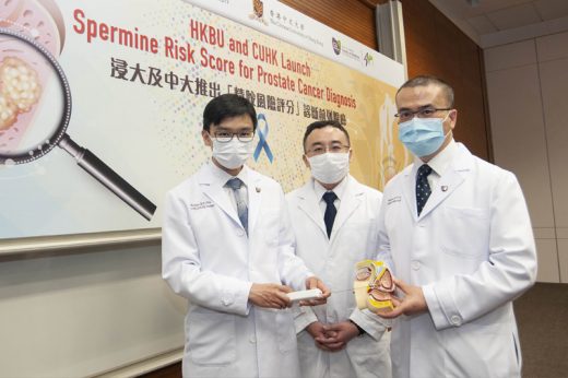 前列腺癌診斷｜浸大中大推「精胺風險評分」識別前列腺癌 助減少不必要活檢（附6種食物保護前列腺）
