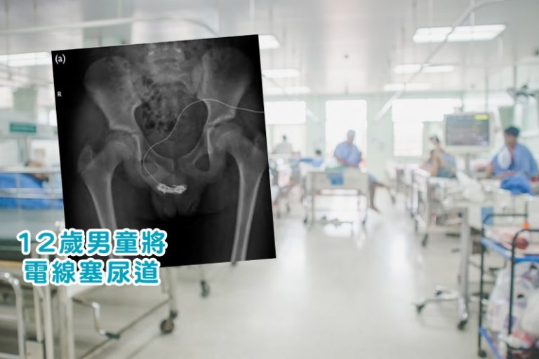 醫學雜誌刊疫下2男童異物塞體內