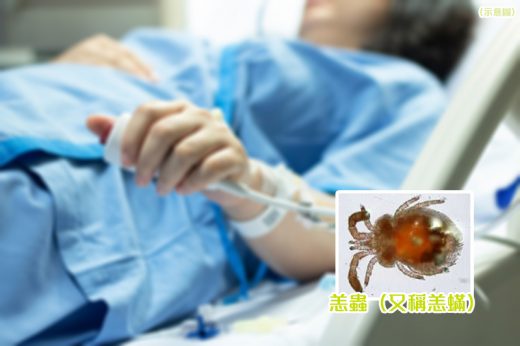 防蟲方法｜大媽跳廣場舞被恙蟲叮咬後發高燒、肝臟損傷病危（附預防恙蟲叮咬貼士）