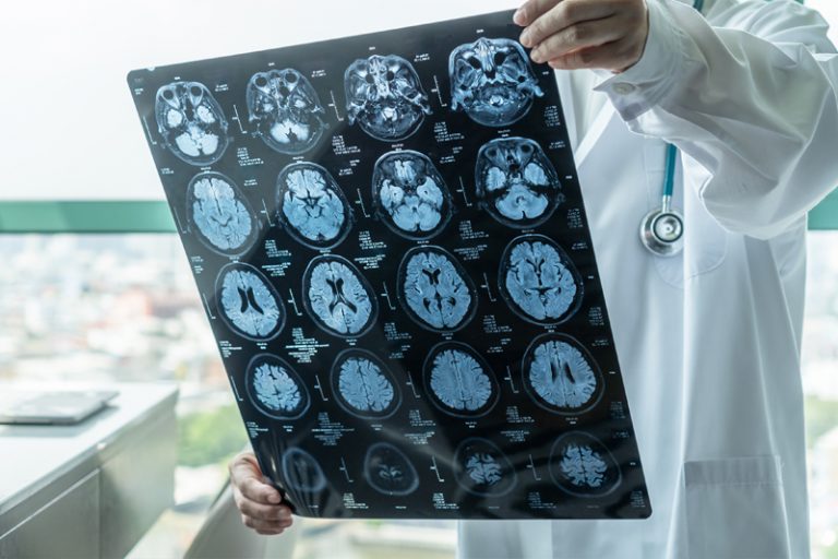 眼眉跳-面部抽搐-診斷