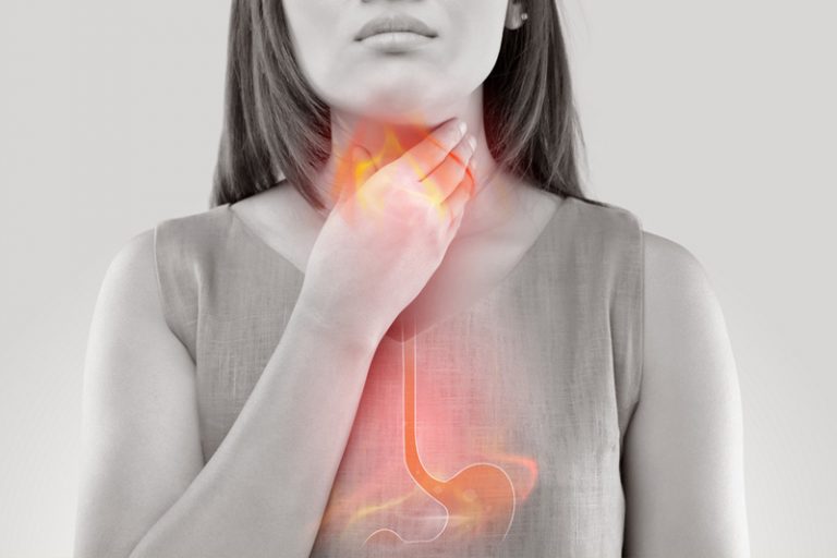 胃酸倒流可致食道潰瘍 嚴重可誘發癌症