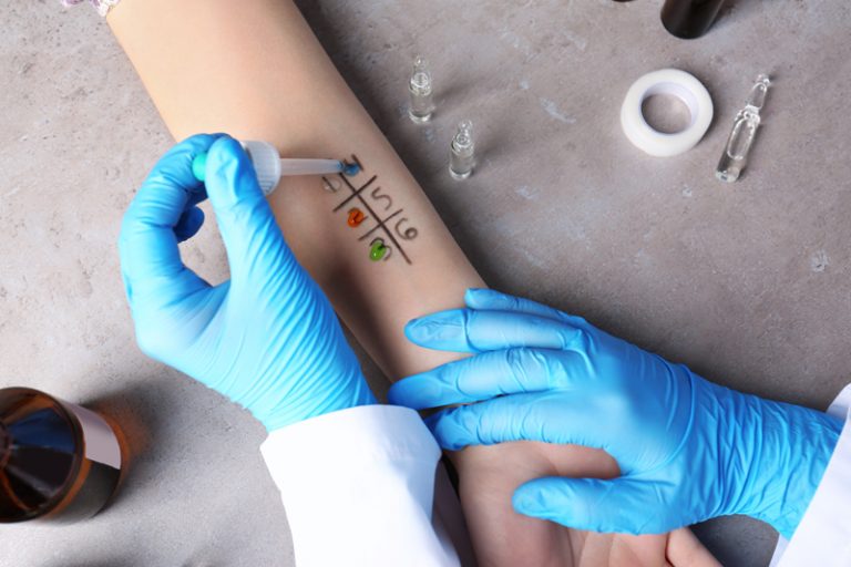 皮膚敏感-鼻敏感-食物敏感-過敏症症狀-抗過敏藥比較-敏感測試