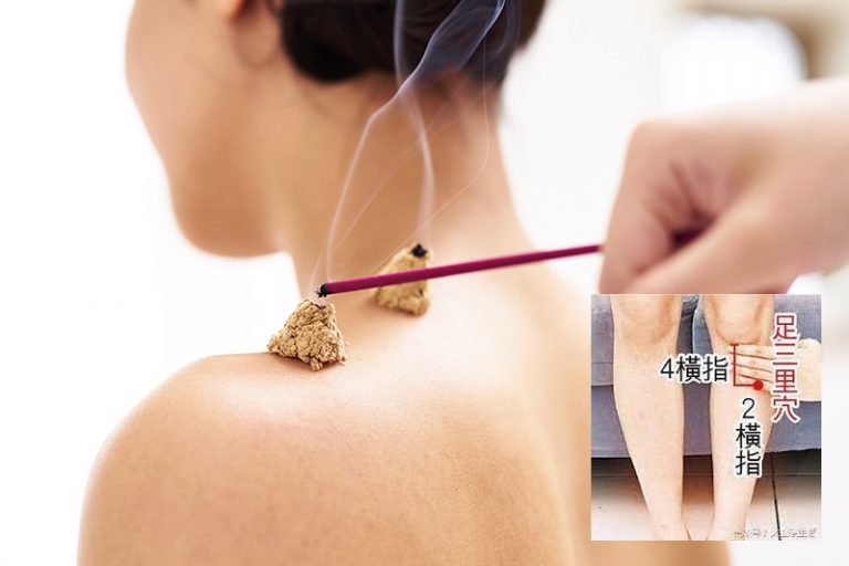 廿四氣節-雨水-艾條艾灸-足三里