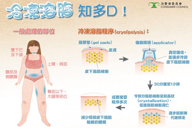 消委會．冷凍溶脂有無用？