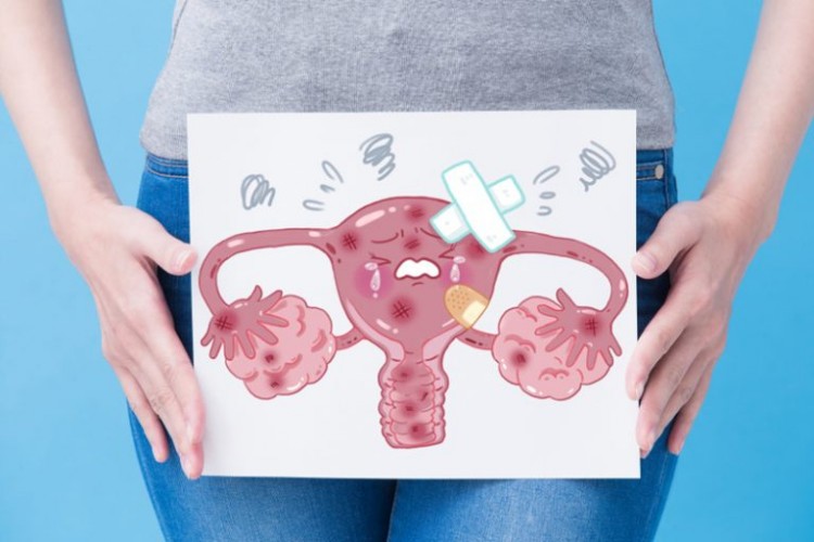 經痛-M痛-中醫治療方法