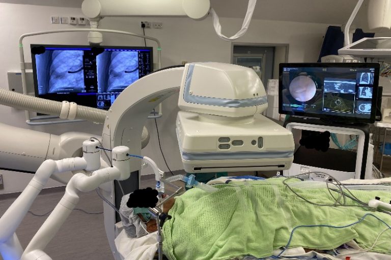 中大成功完成混合手術室機械人輔助支氣管鏡活檢