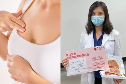 乳癌｜乳房摸到硬塊不一定是癌症！醫生建議婦女宜定期做造影、抽針檢查