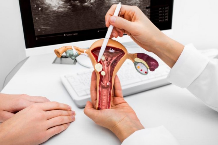 多囊卵巢綜合症-病症-診斷-中醫治療-預防方法