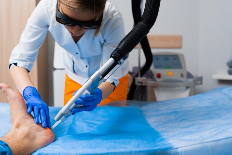 激光-疣自己消失-病毒疣-手指-尋常疣-扁平疣-腳底疣-性病疣-成因-治療-皮膚科醫生-胡惠福