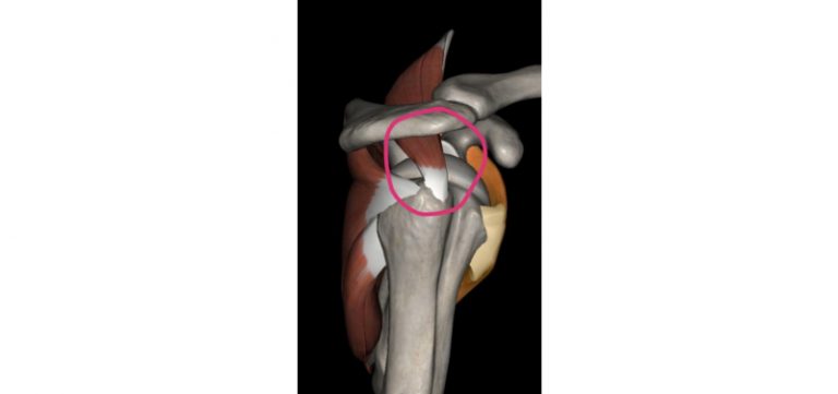 甚麼是五十肩-肩周炎-肩膀痛-成因-症狀-自我檢查-治療