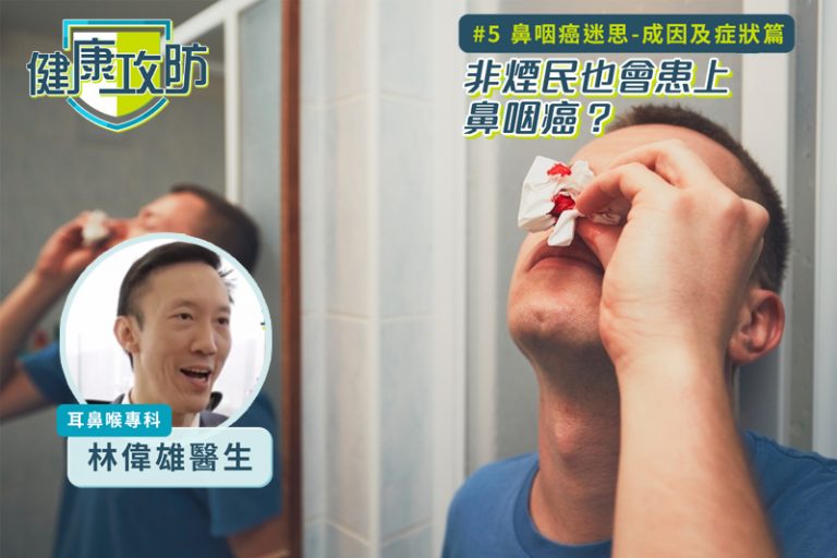 健康攻防｜鼻咽癌迷思｜耳鼻喉科林偉雄醫生拆解成因及症狀篇：非煙民也會患上鼻咽癌？