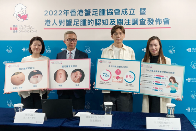 蟹足腫｜調查：7成港人對蟹足腫缺乏認知｜醫生拆解蟹足腫原因和治療方法_圖_1