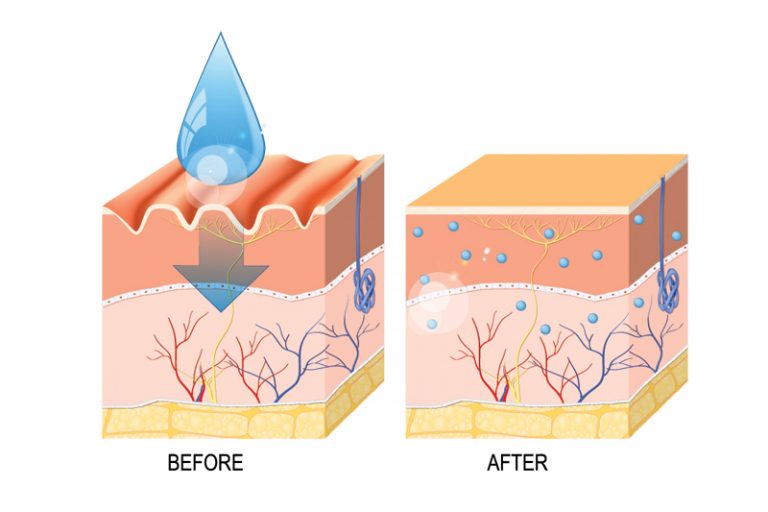透明質酸功效-副作用-注射-塗抹-口服-分別-袁靜怡醫生