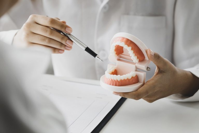 傳統牙箍vs透明牙箍大不同