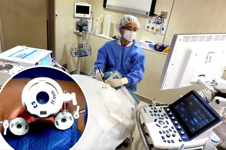 甲狀腺結節治療-無疤微創手術-耳鼻喉科專科醫生李學楠